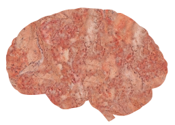health neurology medical organ anatomy mind memory mental scan biology anatomical brain human body science 