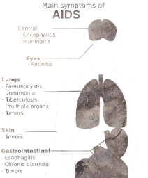 diaphragm problems aids hiv biology lungs human big muscles die disease stomach respiratory medicine treatment detailed body science mouth heart study skin screen you brain care to diagram teaching picture infection patient treat 