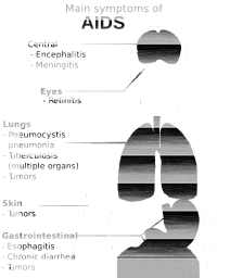 diaphragm problems aids hiv biology lungs human big muscles die disease stomach respiratory medicine treatment detailed body science mouth heart study skin screen you brain care to diagram teaching picture infection patient treat 